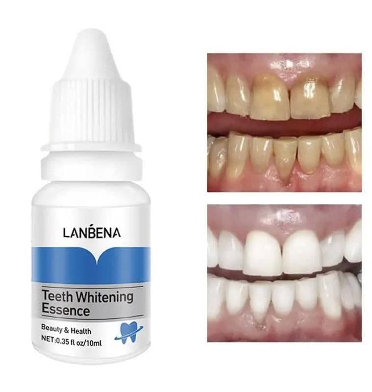 محلول سفید کننده دندان لانبنا حجم 10 میل