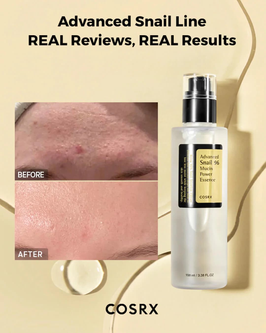 سرم اسنس حلزون کوزارکس