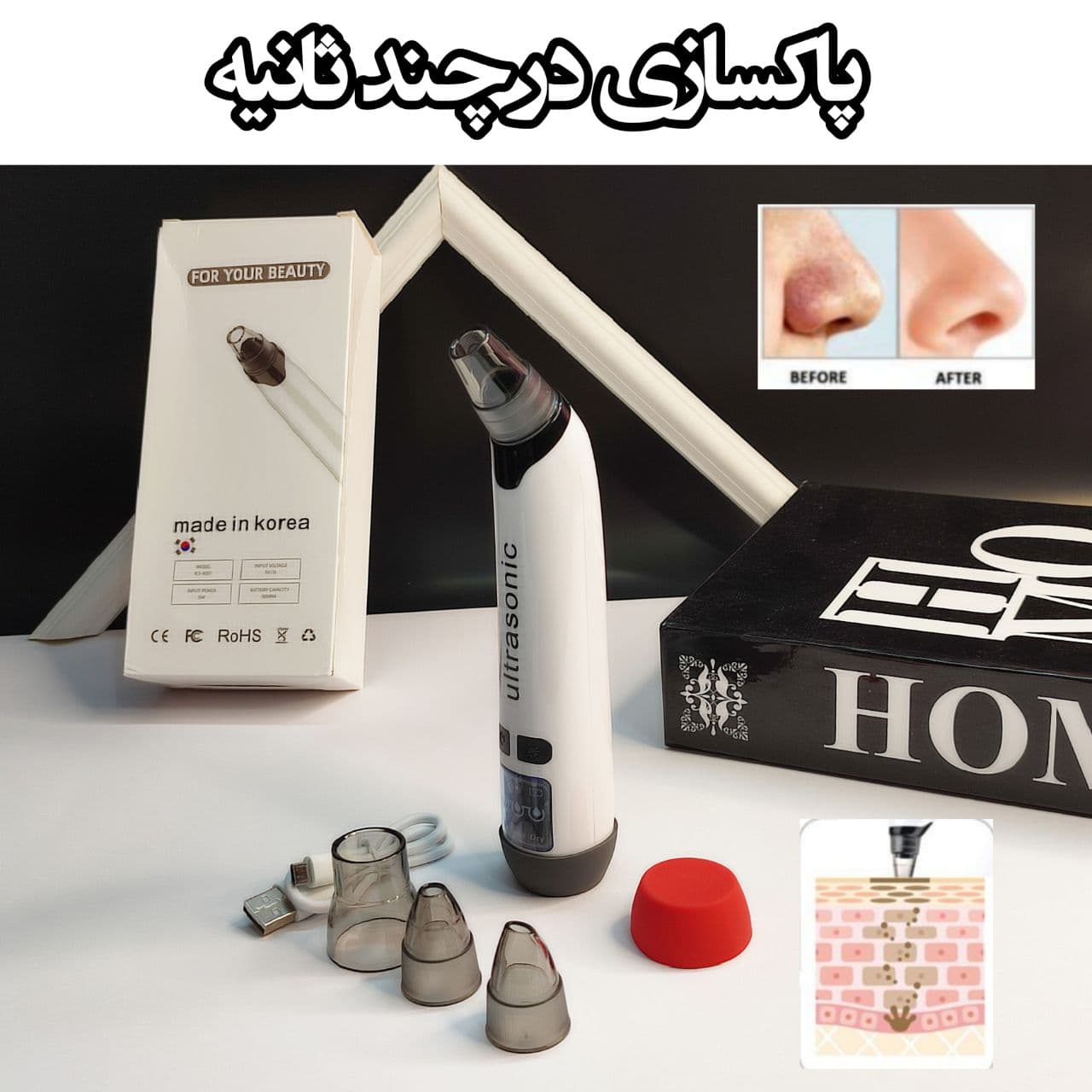 میکرودرم التراسونیک اصل مدل X007