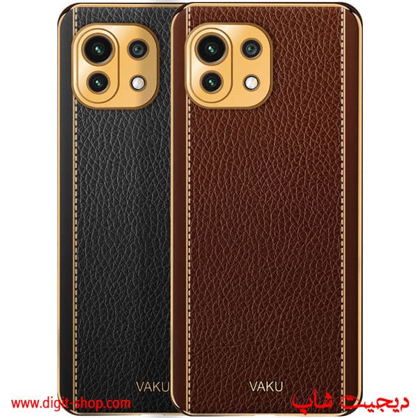 قاب می 11 لایت شیائومی Xiaomi