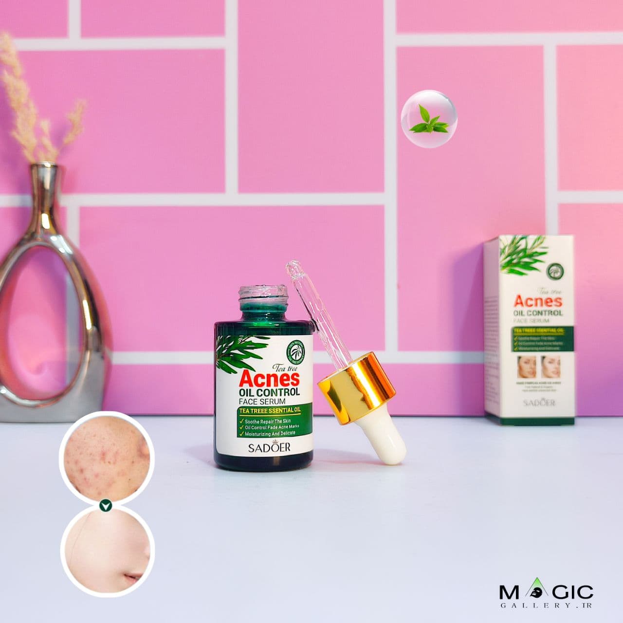 سرم ضد جوش چای سبز سادور کنترل چربی، آبرسان پوست حجم ۳۰ میلی لیتر