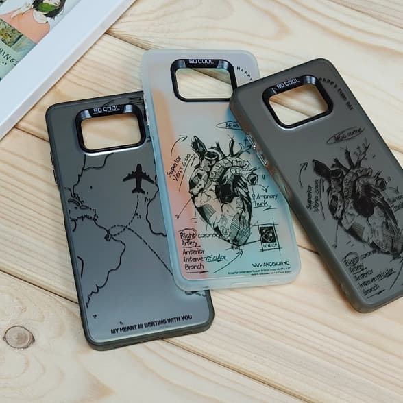 قاب So Cool فانتزی Xiaomi Poco X3 / X3 NFC / X3 Pro